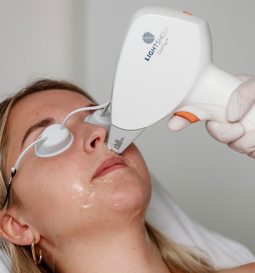 By Jelinka - laserontharing